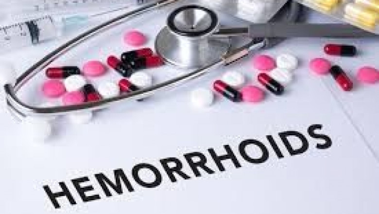 Breaking Down the Hemorrhoid Drugs Market: Innovations, Demand, and Future Potential