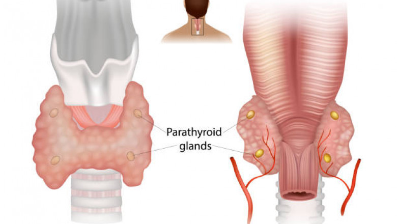 Parathyroid Disorders and Bone Health: What You Should Know