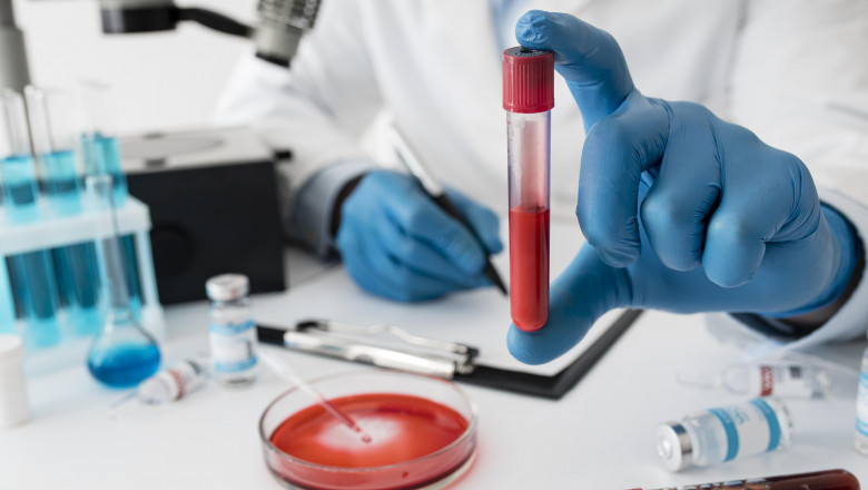 Behind the Scenes of Your Body: What Blood Tests for Liver Function Reveal