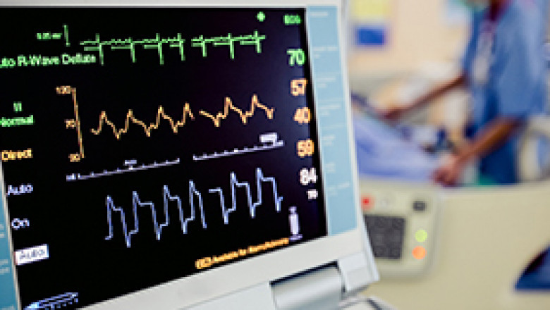 ECG Market Size and Share with Growth Outlook and Demand Trends