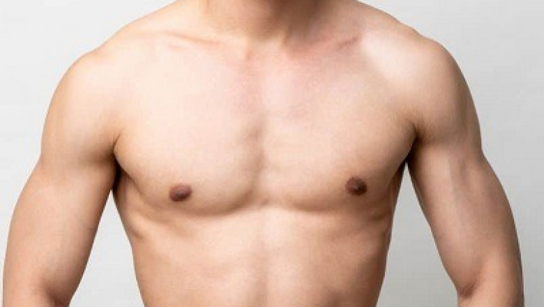How to Recognize Gynecomastia and Surgery Cost