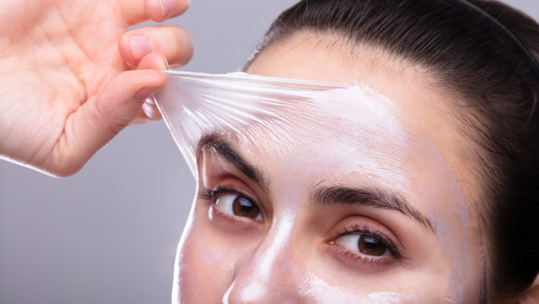 Chemical Peels Cost: Your Budget-Friendly Guide