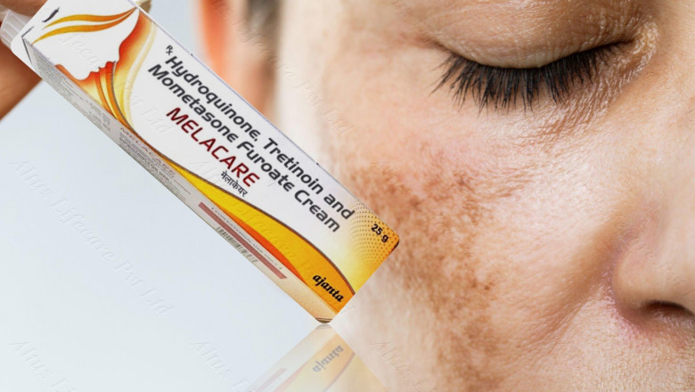 Discover the Melacare Forte Miracle: Your Path to Flawless Skin Starts Here!
