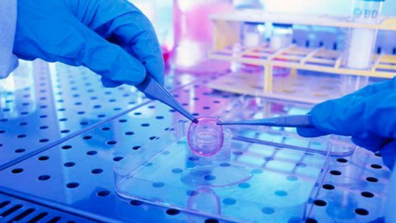 Exploring the Latest Advancements and Trends in Tissue Transplantation Products And Services
