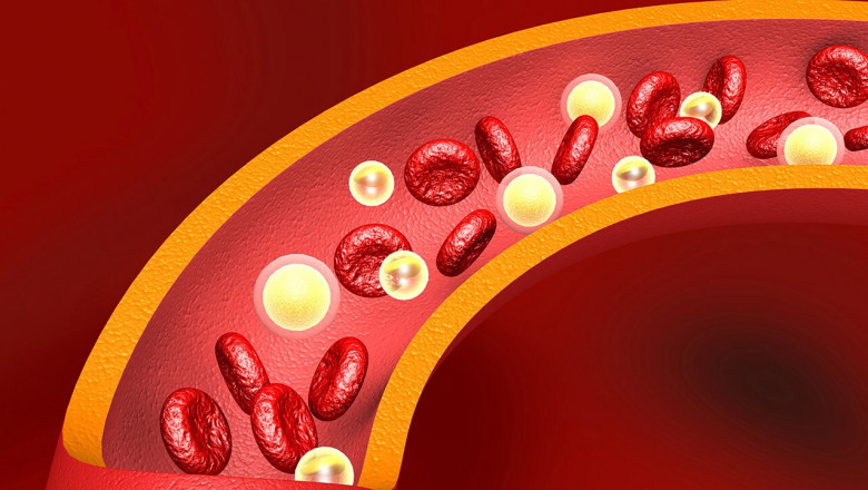 Homozygous Familial Hypercholesterolemia Market to Surge on Novel Therapeutics