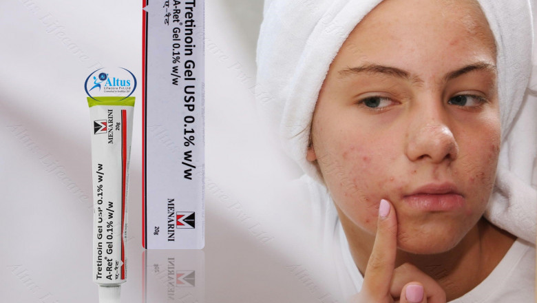 Stunning Retin A Before and After Transformations That Defy Aging!