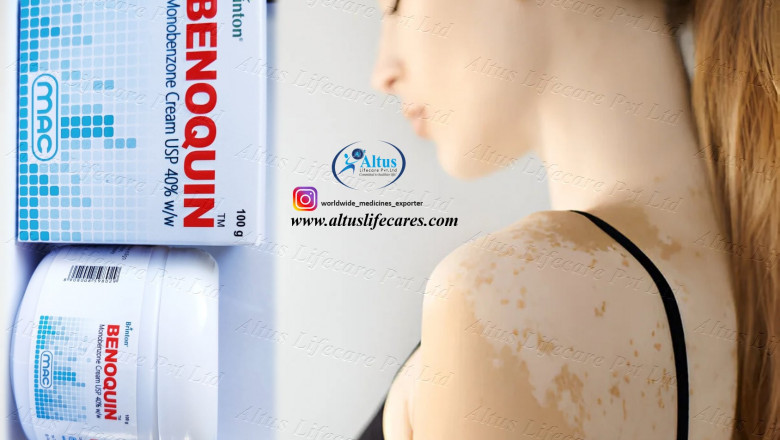 The Power of Benoquin 60% Cream: A Breakthrough Treatment for Vitiligo