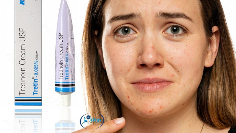 The Ultimate Tretin 0.025 Cream Experience: Radiant Skin Awaits – Discover How!