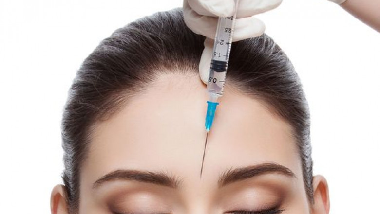 Botox Injection for Forehead Lines