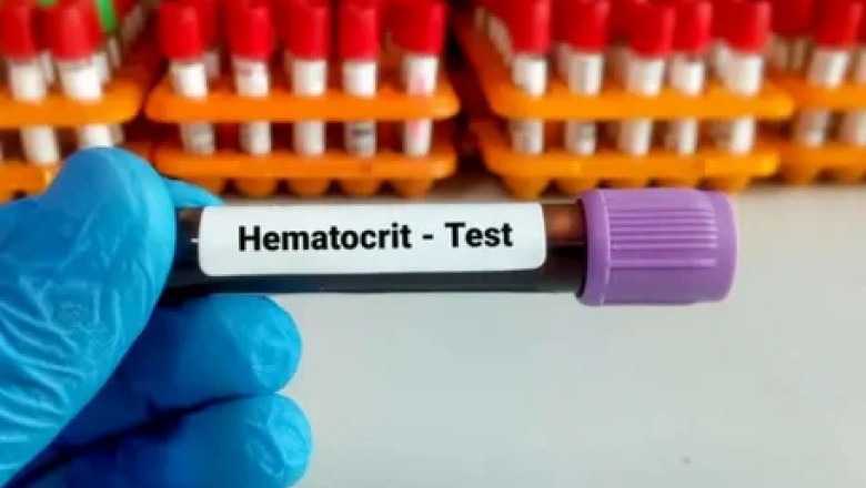 Growth Prospects and Challenges in the Hematocrit Test Market