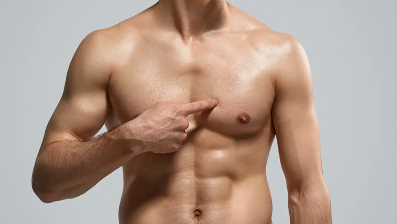 Gynecomastia in Men: What Causes Breast Tissue Growth?