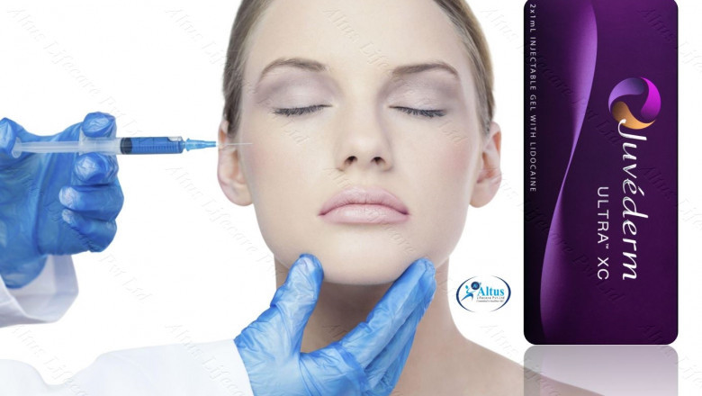 Juvederm Ultra Lips Fillers: Discover the Easiest Way to Get Sensational Lips