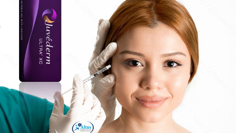 "Juvederm Ultra XC: Unleash Your Natural Beauty"