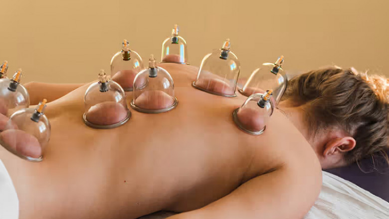 Unlock Deeper Relaxation: The Benefits of Cupping Massage