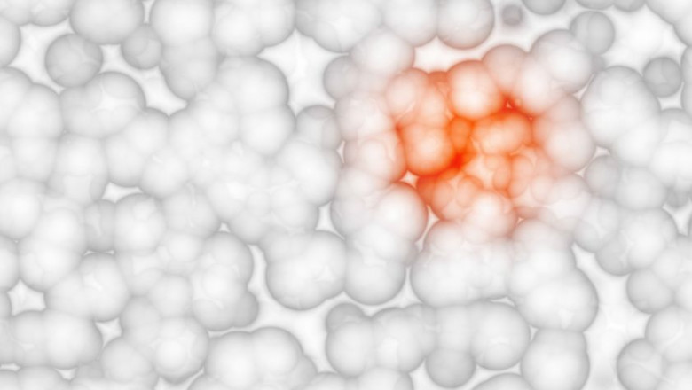 Astrocytoma Drug Market Poised for Growth With Targeted Therapies