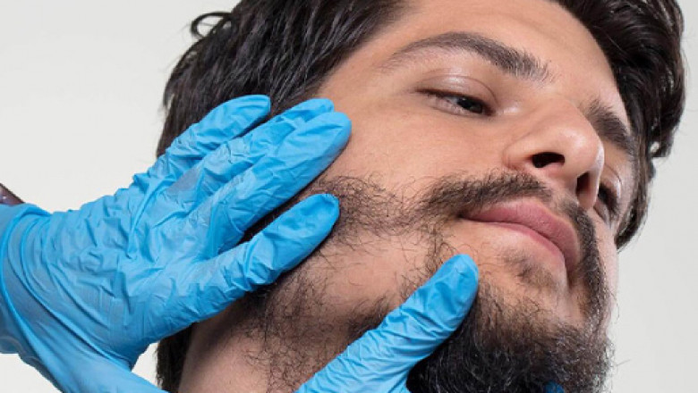 Beard Hair Transplant: Ethical Considerations