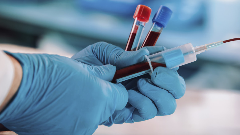 Blood Dialyzer Market to Surge on High-Flux Membrane Innovations