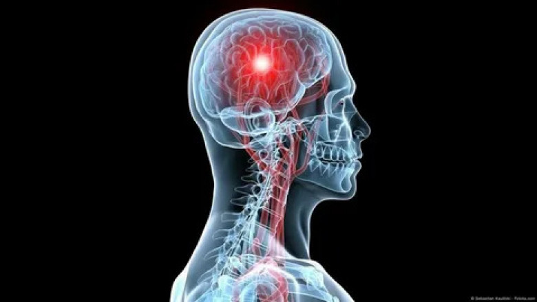 Cerebral Somatic Oximeters Market Booms with AI-Driven Analytics