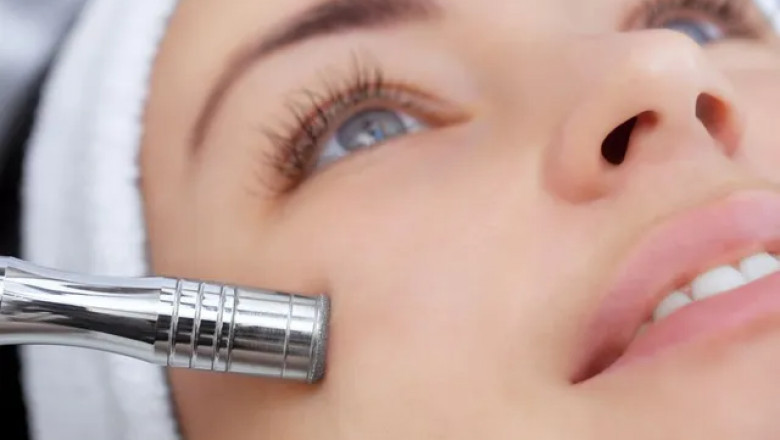 Chemical Peels After Botox: The Perfect Skin Care Combo | Bel Viso Medical Spa 💉✨
