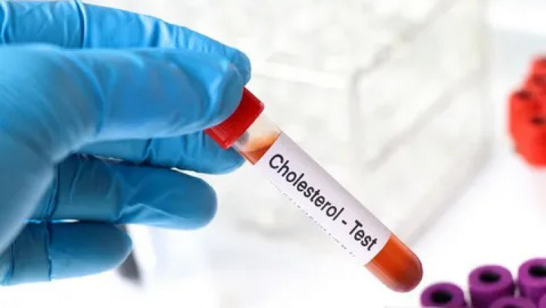 Cholesterol Testing Services Market to Surge via Point of Care Diagnostics
