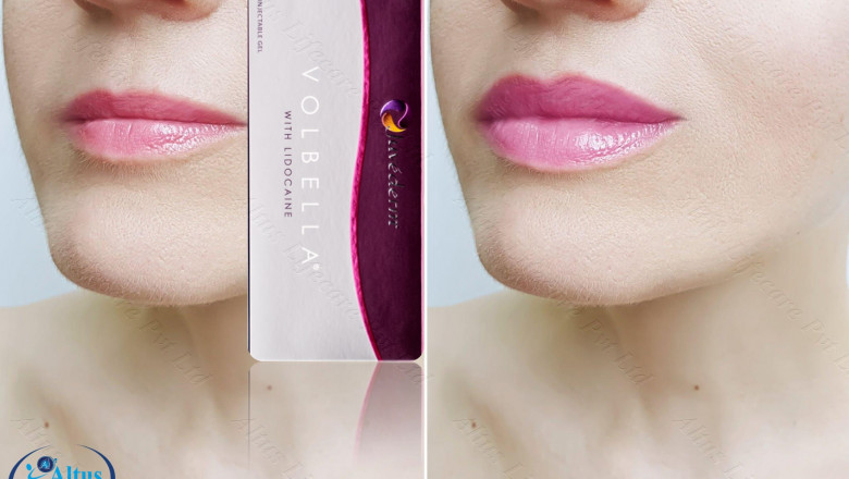 Juvederm Voluma XC: Get Ready for a Total Transformation – Unbelievable Results