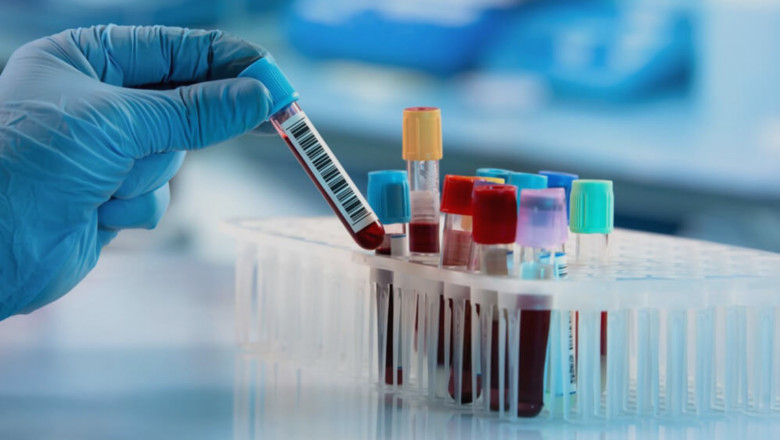 Point-of-Care Innovation Driving Growth in Mexico In-Vitro Diagnostics