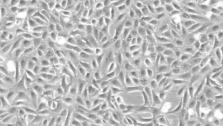 Vero Cells: A Comprehensive Guide to Their Role in Vaccine Development and Biomedical Research