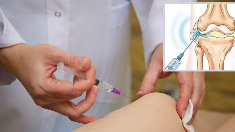 Viscosupplementation Market Dynamics Shift With Entry of New Biopharma Players and Strategic Partnerships