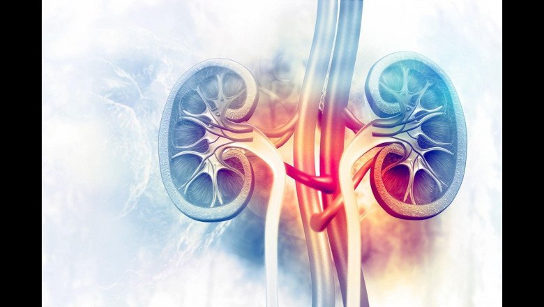 End-Stage Renal Disease Treatment Market to Surge with AI-Powered Dialysis