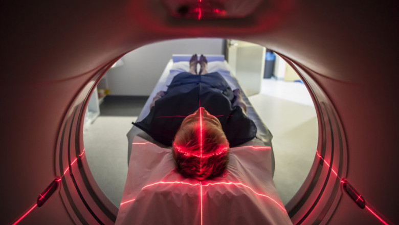 Exploring the Canada Nuclear Medicine Market: Trends, Scope, and Outlook