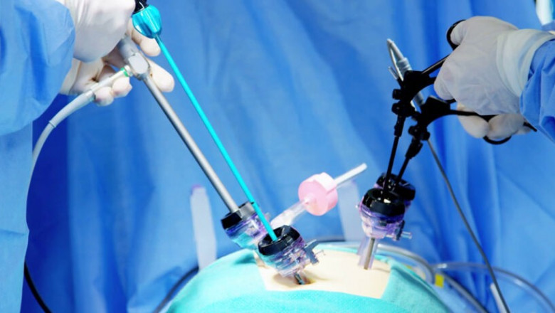 Laparoscopic Hepatobiliary Surgery in Delhi: Clinical Excellence with Faster Recovery