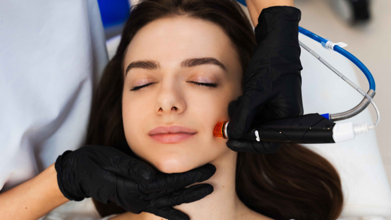 Top 5 Benefits of HydraFacial for Dry and Flaky Skin