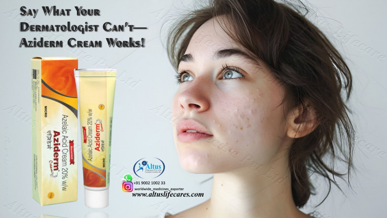 Aziderm 20% Cream The Ultimate Solution for Beautiful Skin!