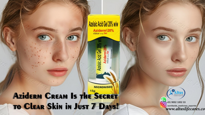 Aziderm 20% Gel Your Secret to Clear, Glowing Skin!