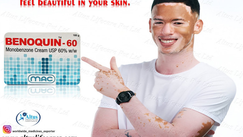 Benoquin 60% Cream - Monobenzone 60% Cream