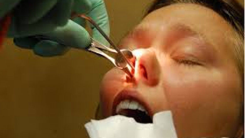 Consulting for a Deviated Septum in El Segundo: When to See a Specialist