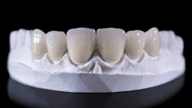 Dental Ceramic Market segmentation by material type and end-user applications