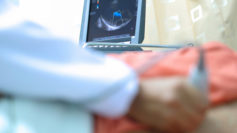 Echocardiography Devices Market Forecasted to Grow with AI Integration