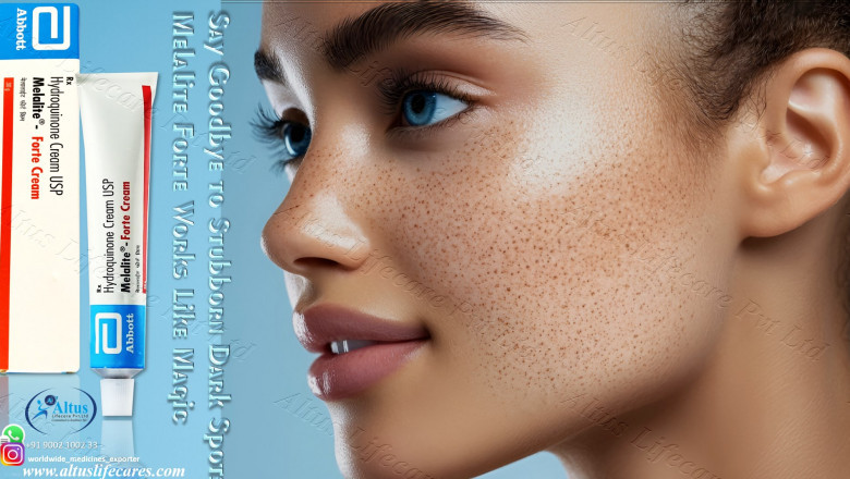 Melalite Forte Cream Experience the Beauty of Clear Skin – Your Skin Deserves It!