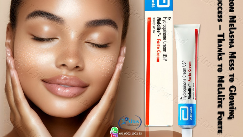 Melalite Forte Cream: "Review Does It Really Work Wonders on Your Skin"