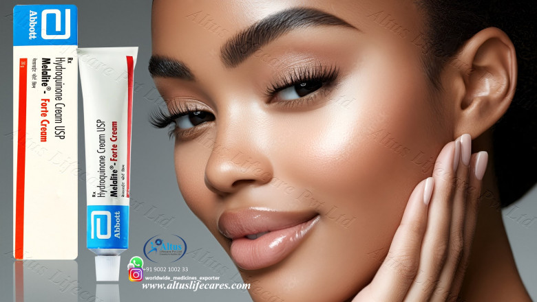 Melasma Management: Unveiling the Efficacy of Melalite Forte Cream