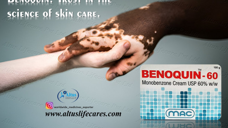 One Cream, One Cure? What Benoquin Monobenzone 60% Cream Is Doing for People with Vitiligo