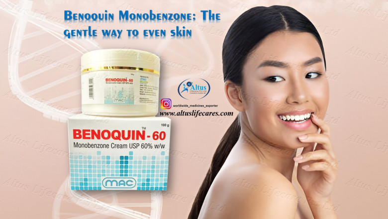 The Internet Is Obsessed with Benoquin 60% Cream – Here’s Why Vitiligo Patients Are Talking!