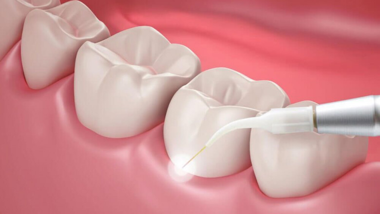 Tooth Regeneration Market to Surge with Bioengineered Scaffolds