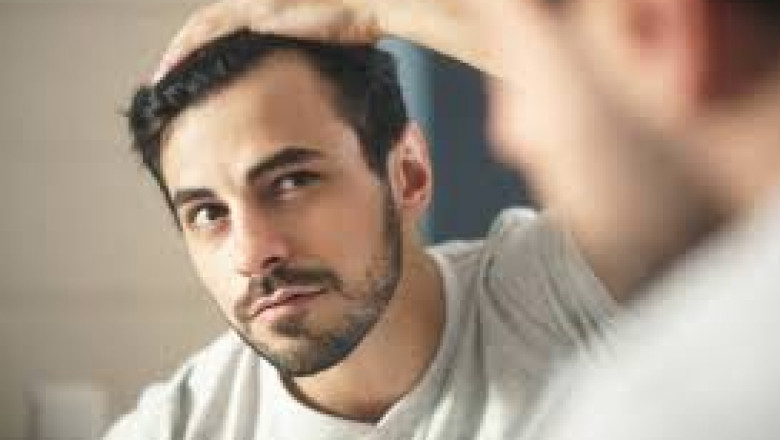 Hair Restoration for Men in El Segundo: Top Clinics & Treatments for Natural Results