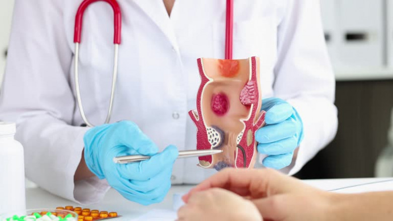 PROCTOLOGIST IN CHENNAI – EXPERT CARE FOR PILES, FISSURES & FISTULAS