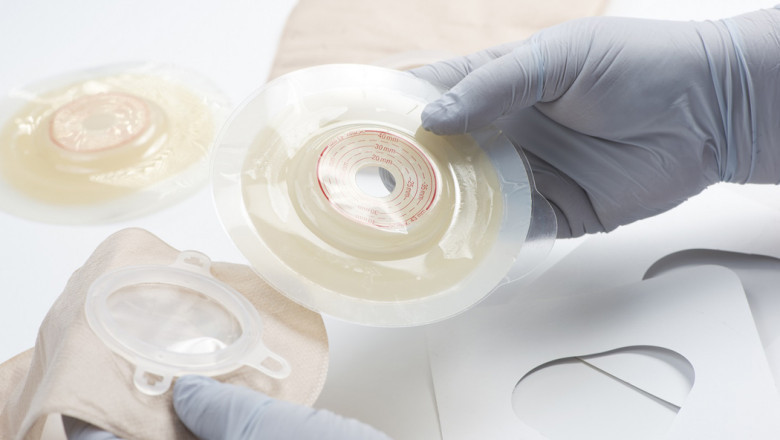 Surge in Colostomy Procedures Positively Impacting the Ostomy Devices Market Growth