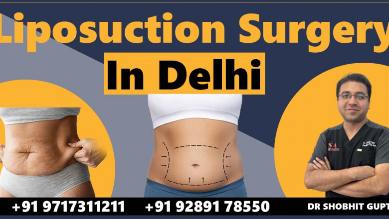 Transform Your Body with Liposuction Surgery in Delhi