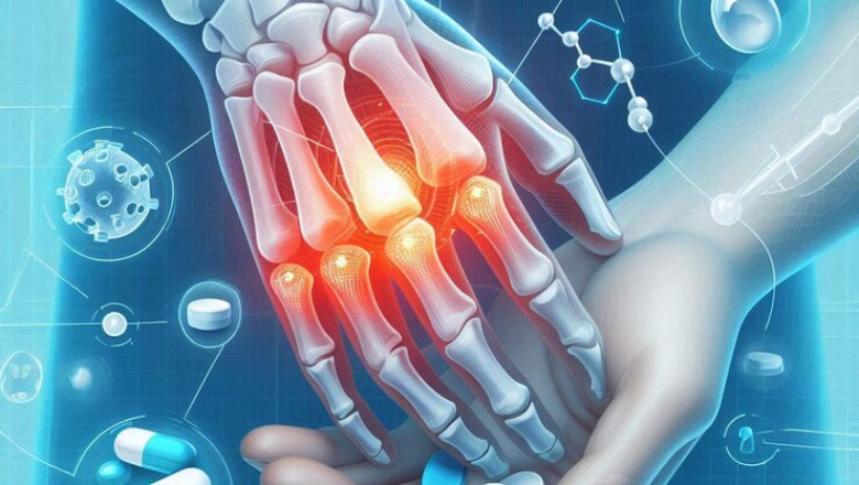 Arthritis Therapeutics Market Intelligence Unlocks New Frontiers in Targeted Treatment Approaches
