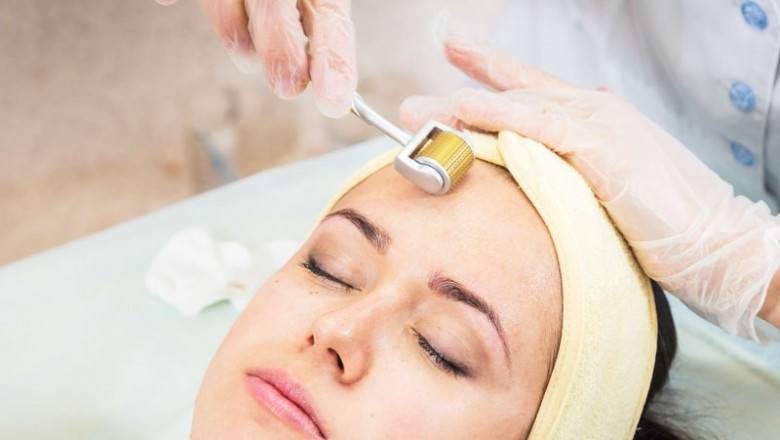 Get the Glow You Deserve with Microneedling Treatment In Delhi